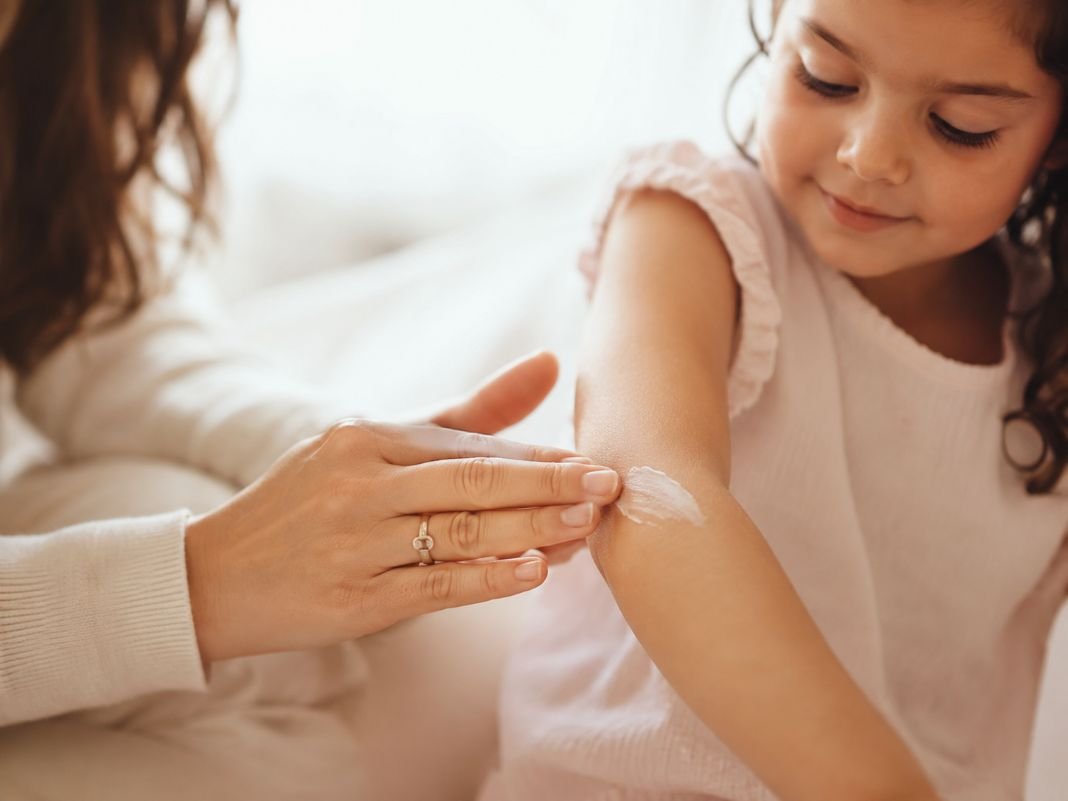 A parent gently applying moisturiser to their child's arm at home — illustrative image